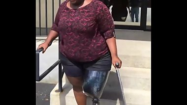 Bbw RAK amputee with prosthetic